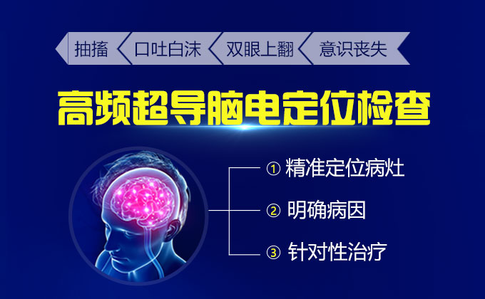 北京哪家的医院擅长治疗癫痫病